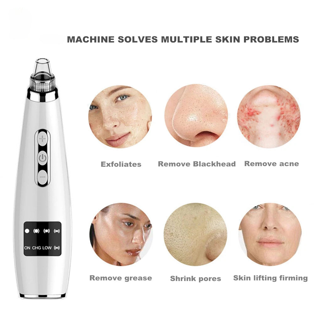 Blackhead Remover Vacuum Deep Nose Cleaner T Zone Pore Acne Pimple - MAGM Enterprises LLC